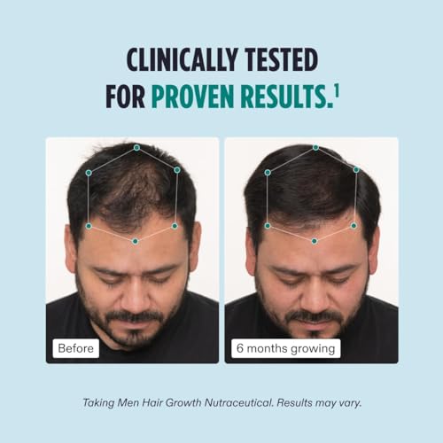 Nutrafol Men’s Hair Growth Supplements and Scalp Serum | Clinically Proven for Thicker, Stronger Hair | 2-Tiered Hair Support System